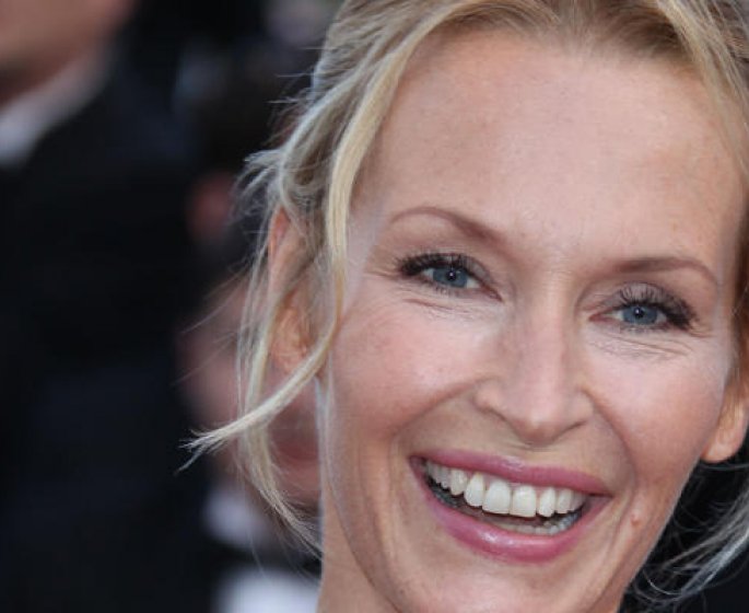 Botox : Estelle Lefebure evoque son recours a la chirurgie esthetique