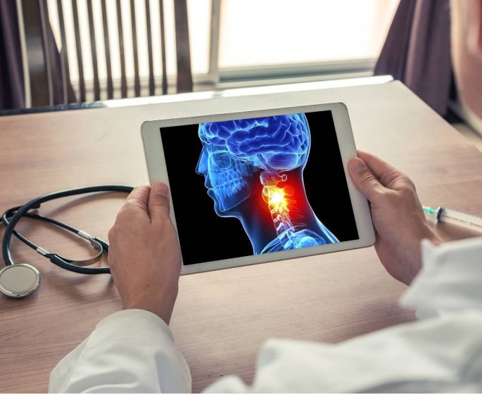 Cancer de la tete et du cou : 6 signes qui doivent alerter selon un medecin