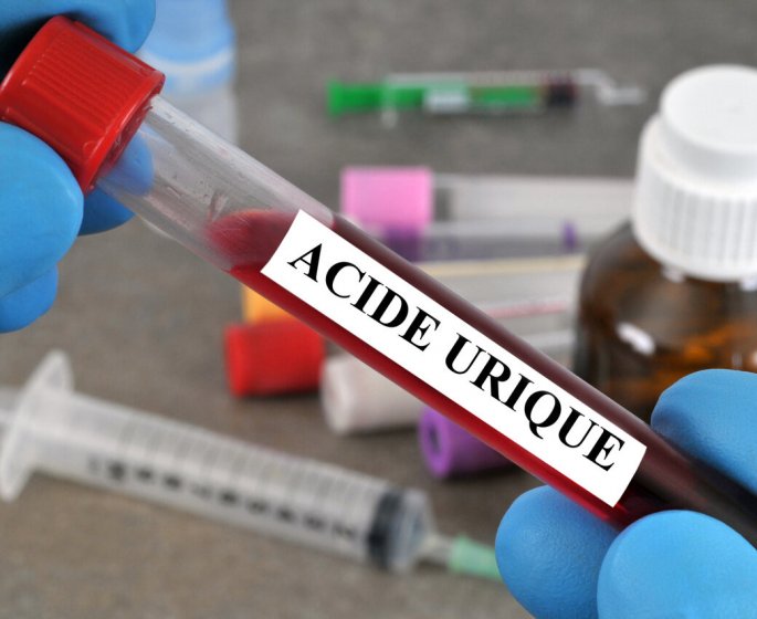 Acide urique : 6 elements qui peuvent expliquer un taux trop eleve