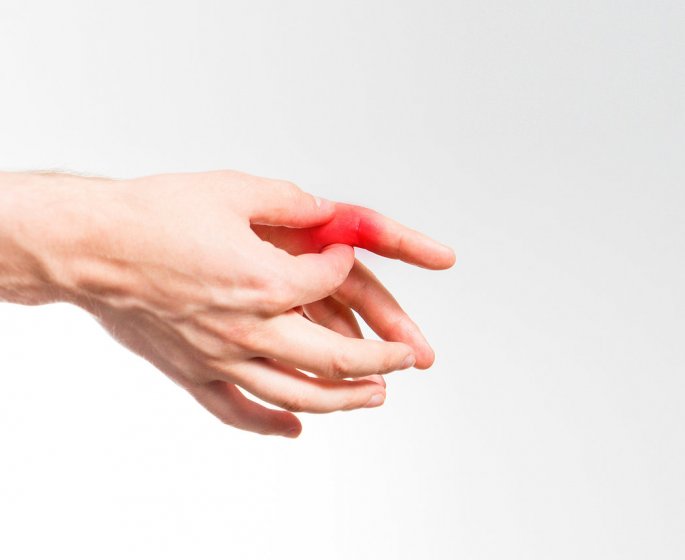 Maladie de Raynaud : 5 signes a reconnaitre sur vos mains