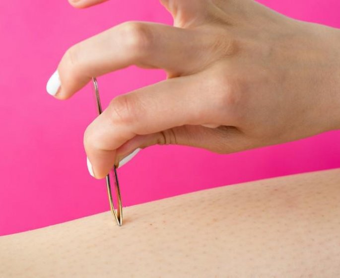 Piqure de guepe : ce qu-il ne faut surtout pas faire 