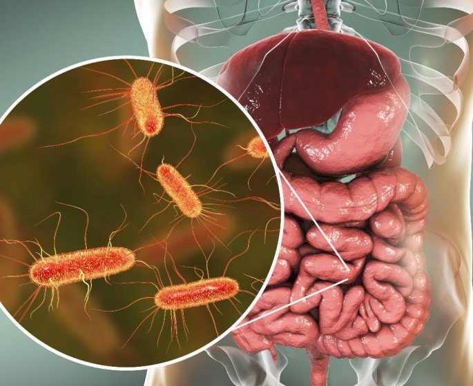 Bacterie E. coli : 5 aliments a surveiller pour eviter les risques