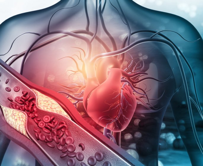 Les 7 conseils de la cardiologue pour eviter d’avoir les arteres bouchees