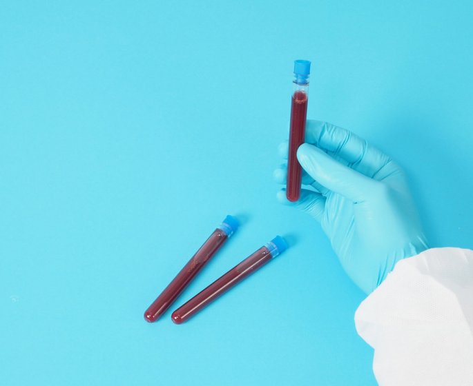 Triglycerides : 7 signes qui prouvent qu-elles sont trop elevees