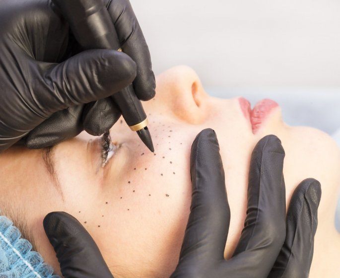 Cerne, vergetures, cicatrices... Ce tatoueur aide les femmes a aimer leur corps