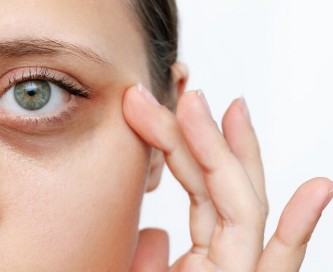 Cernes : 5 astuces alimentaires pour les contrer