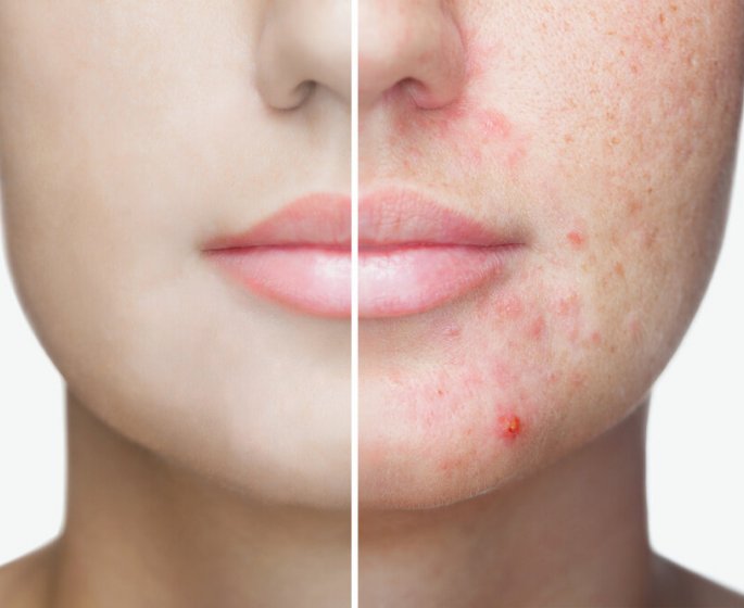 Visage : ce que vous devez arreter de faire pour avoir une belle peau 