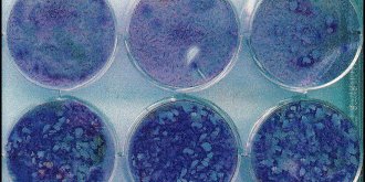 Zona : symptomes, causes, traitements, est-il contagieux ?