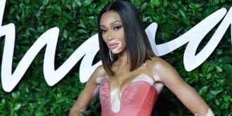 Vitiligo (taches blanches, depigmentation de la peau) : causes et traitements 
