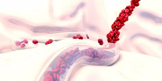 Purpura (rhumatoide, fulminans, thrombopenique, vasculaire) : quels traitements ?
