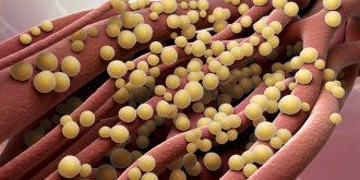 Furoncle : symptomes, causes et traitements