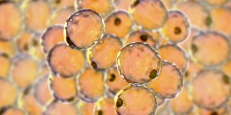 Lipome (tumeur ou boule de graisse) : comment l-enlever ?