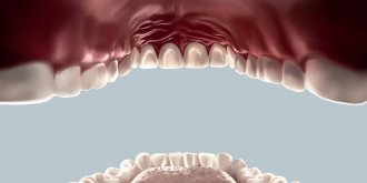 Stomatite : comment soigner l’inflammation de la muqueuse de la bouche ?