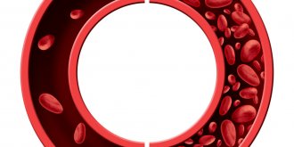 Anemie : symptomes, causes, traitements, risques et complications
