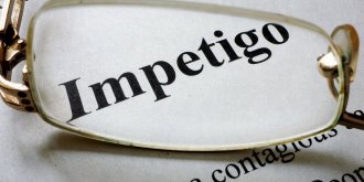 Impetigo : causes, traitements, symptomes, contagion
