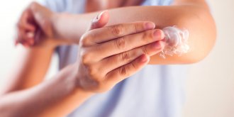 Eczema : causes, traitements, est-il contagieux ?