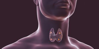  Hypothyroidie et hyperthyroidie : les symptomes sont-ils differents ?