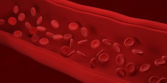 Arteriosclerose : definition, causes, examen, traitements