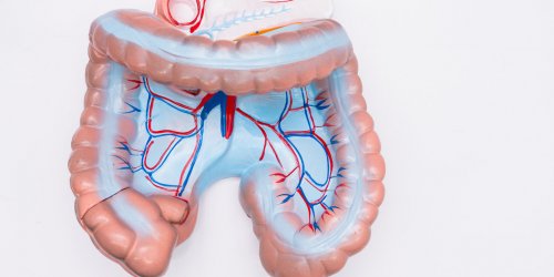 Carcinose peritoneale ou cancer du peritoine : symptomes, evolution, traitements