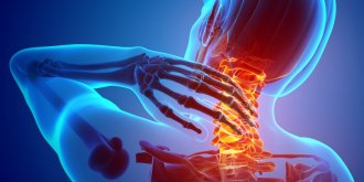 Cervicalgie : symptomes, complications, traitements
