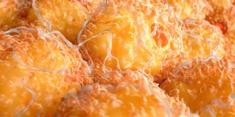 Obesite : moderee, severe, morbide, quels traitements et solutions ?