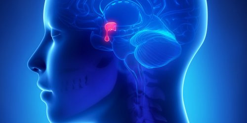 Adenome de l-hypophyse : symptomes et traitements des tumeurs hypophysaires