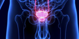 Adenome de la prostate : traitements, symptomes, causes, complications