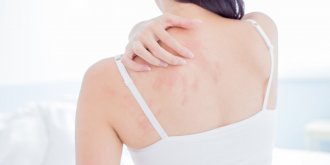 Eczema (ou dermatite allergique) de contact : symptomes et traitements pour le soigner