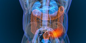 Symptomes esperance de vie causes et traitements du cancer colorectal