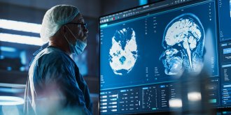 Malformation arterioveineuse cerebrale : symptomes, causes et traitements