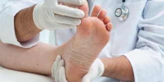 Pied d-athlete ou Mycose des pieds entre les orteils : quels traitements ?