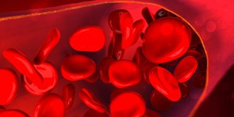 Maladie de Horton (arterite temporale) : symptomes, diagnostic, evolution, traitements 