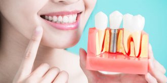Dent sur pivot descellee : que faire ?