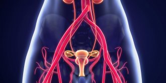 Cystite interstitielle ou syndrome de la vessie douloureuse