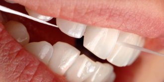 Parodontite : symptomes, causes, traitements, prevention 