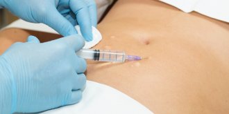 Mesotherapie : la methode pour raffermir le ventre sans chirurgie