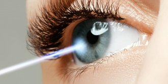 Astigmate : la correction au laser