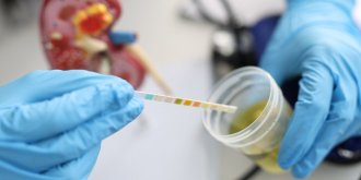 Les americains mettent au point un test urinaire capable de deceler 94 % des cancers de la prostate agressifs