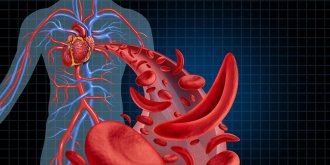 Drepanocytose : quelle est cette maladie genetique tres repandue ?