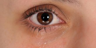 Yeux gonfles qui pleurent : blepharite ou conjonctivite ?
