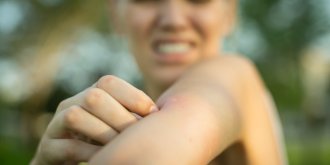 Tiques : comment reagir a une piqure ?