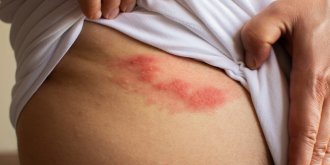 Comment vos vetements abiment votre microbiote cutane