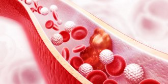 Phlebite : 7 exercices faciles pour l-eviter