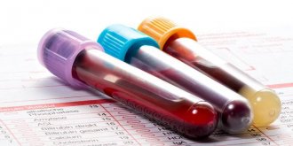 Don de sang : quelles sont les contre-indications ? 