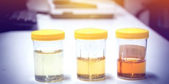 Deshydratation : la couleur de votre urine peut la reveler