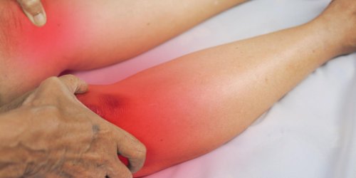 Rhumatisme psoriasique, un rhumatisme inflammatoire chronique 