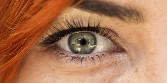 Yeux : la cecite corticale