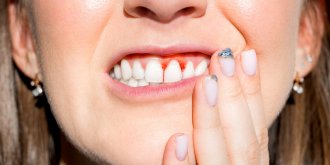 Comment prevenir le dechaussement des dents et les brosser de la bonne facon ? 