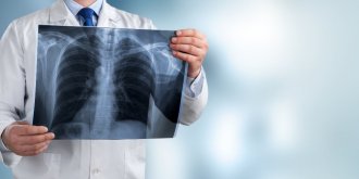 Cancer des os : ce symptome en marchant doit vous alerter