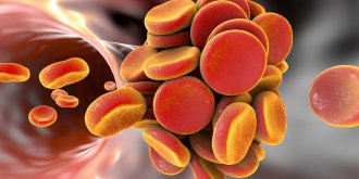 Thrombose : moins de risques avec le vaccin qu-en ayant le coronavirus ?